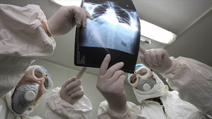 بستری 103 مبتلا به کرونا در ICU های آذربایجان غربی