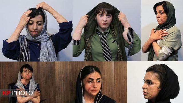 وعده جدید برای هزینه درمان دانش آموزان شین آبادی در سال آینده!
