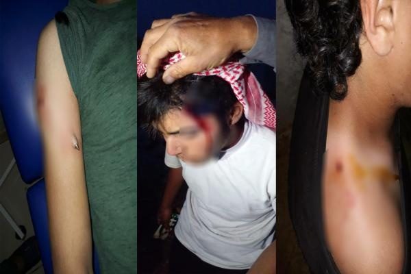 کشته شدن یک کودک و زخمی‌شدن چند تن بر اثر تیراندازی هوایی شبه‌نظامیان وابسته به ترکیه در عفرین
