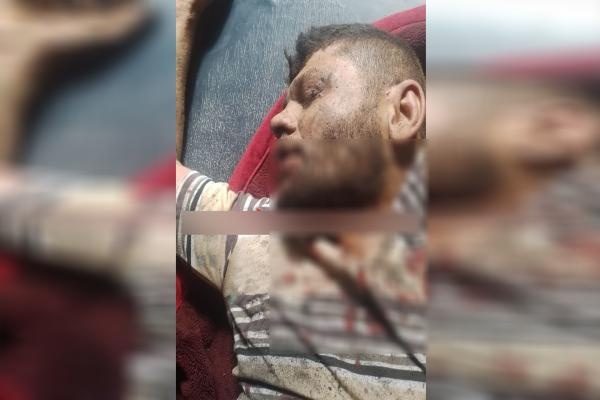 انفجار بمب دست‌ساز در عفرین یک شبه‌نظامی وابسته به ارتش ترکیه را زخمی کرد