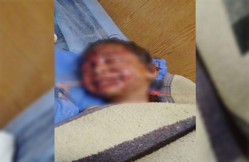 جان باختن یک کودک و زخمی شدن ۴ تن در انفجار بقایای جنگی بازمانده از داعش در دیرالزور