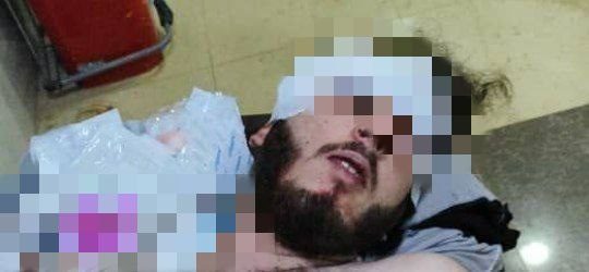 کشته شدن ۳ عضو شبه‌نظامیان وابسته به ترکیه در درگیری میان دو گروه از آنها